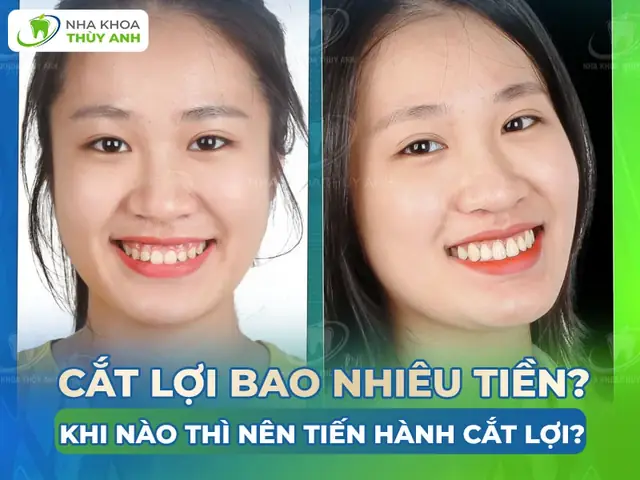 Tướng Cát Lợi Là Gì