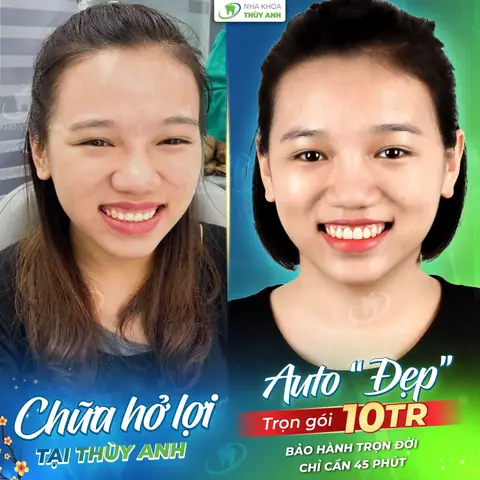 Tướng Cát Lợi Là Gì