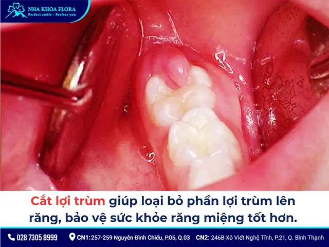 Tướng Cát Lợi Là Gì