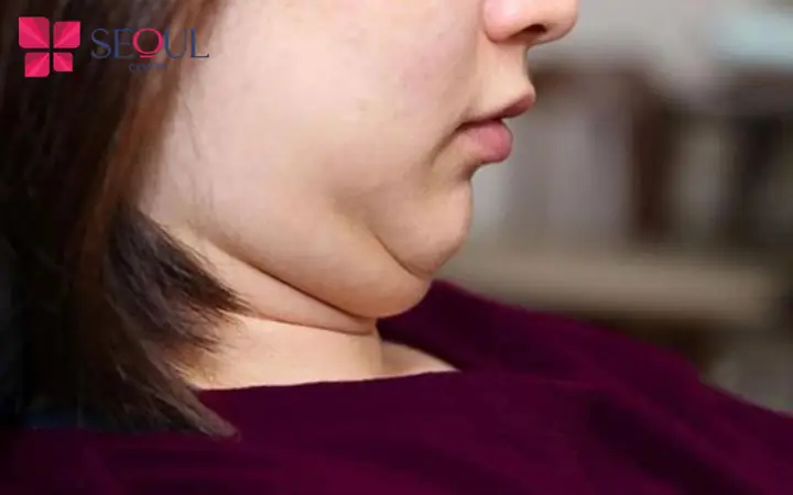 Tướng Cổ Ngắn