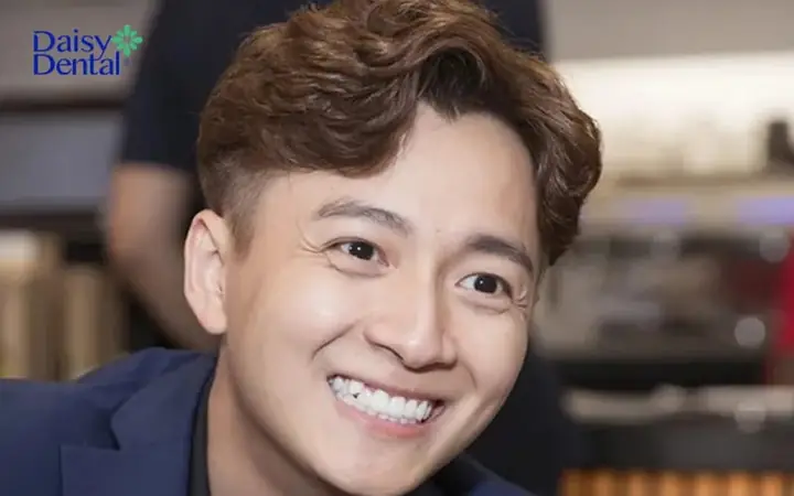 Tướng Đàn Ông Có Răng Khểnh