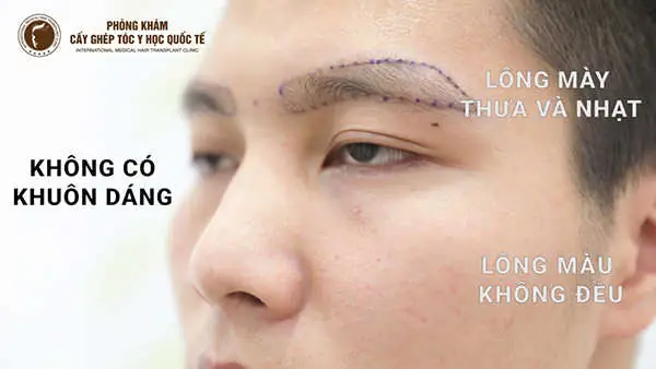 Tướng Đàn Ông Không Có Lông Mày Tướng Đàn Ông Không Có Lông Mày