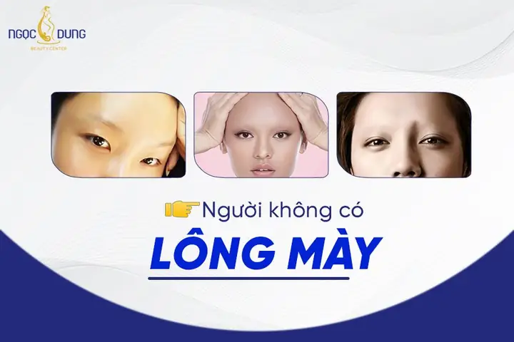 Tướng Đàn Ông Không Có Lông Mày Tướng Đàn Ông Không Có Lông Mày