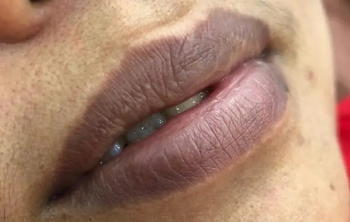 Tướng Đàn Ông Môi Thâm