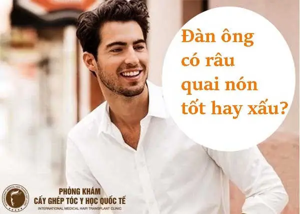 Tướng Đàn Ông Râu Quai Nón