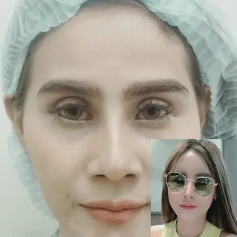Tướng Đàn Ông Thái Dương Hóp