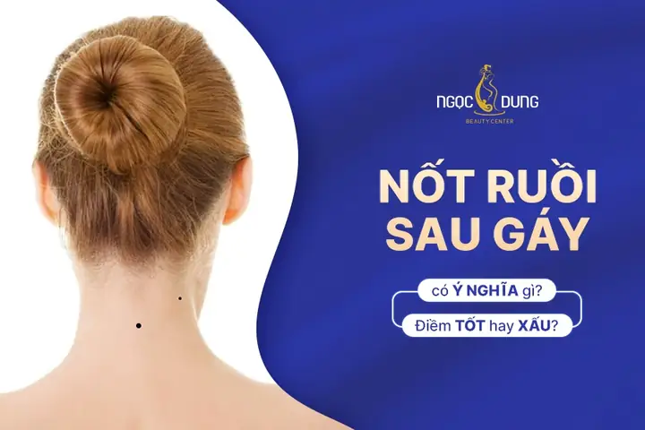 Tướng Gáy Lõm