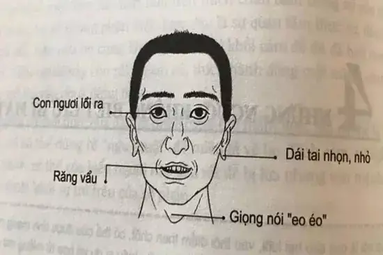Tướng Giọng Nói Đàn Ông