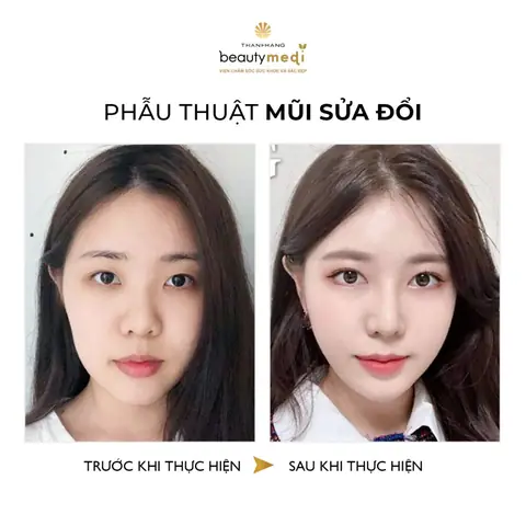 Tướng Lỗ Mũi Hở
