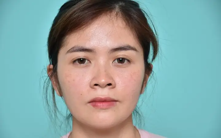 Tướng Lỗ Mũi Hở