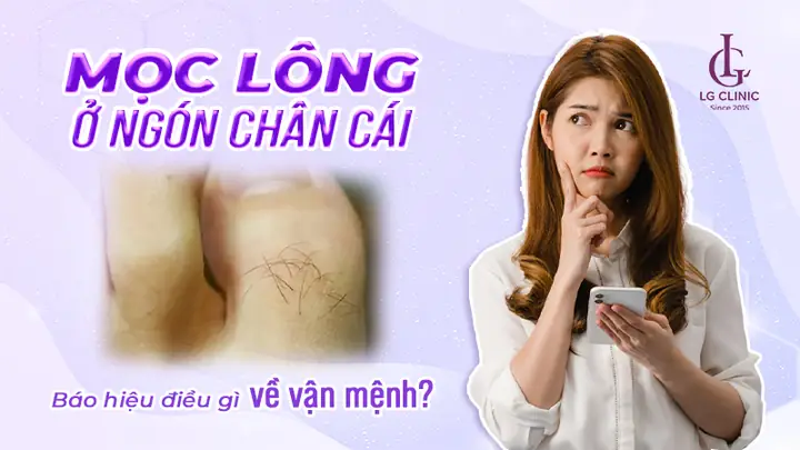 Tướng Lông Ngón Tay