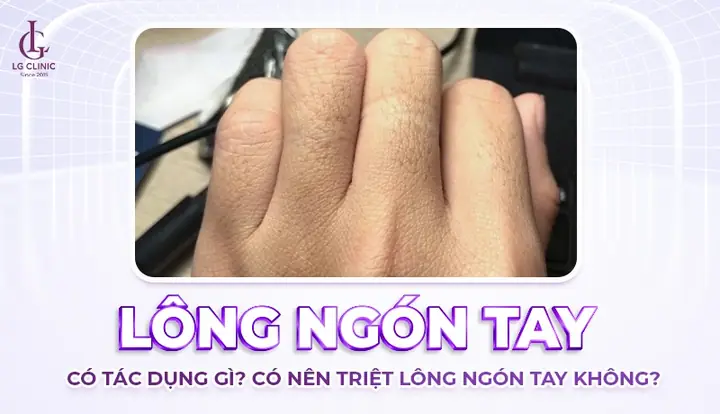 Tướng Lông Ngón Tay Tướng Lông Ngón Tay