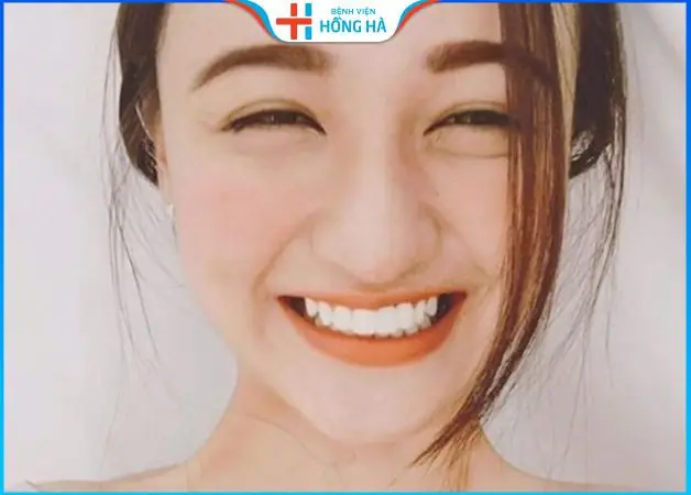 Tướng Mắt Cười