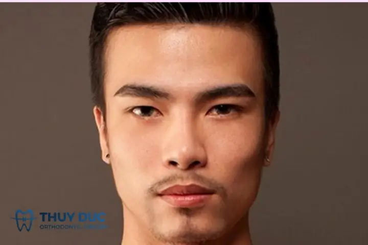 Tướng Mặt Đàn Ông Ác