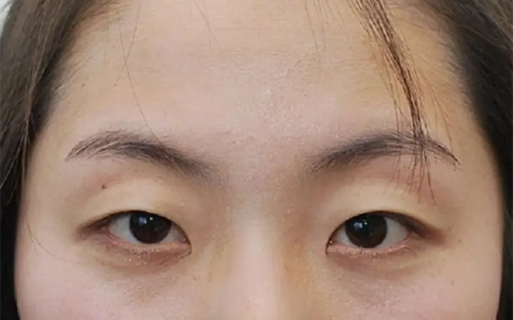 Tướng Mắt Hạc