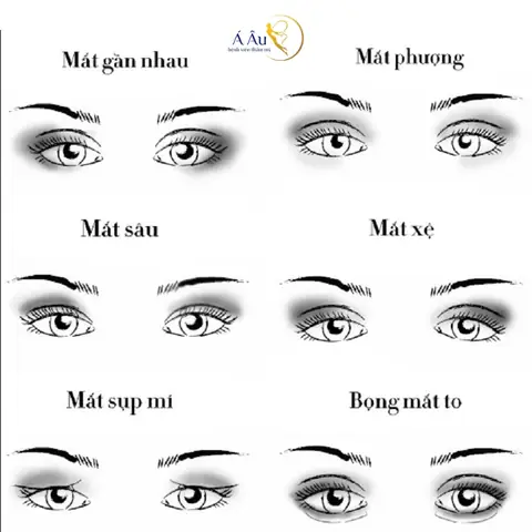 Tướng Mắt Lệch