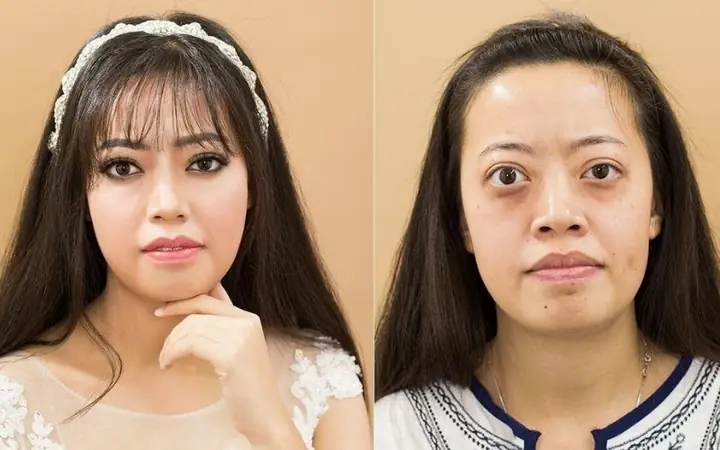 Tướng Mắt Lồi Phụ Nữ Tướng Mắt Lồi Phụ Nữ