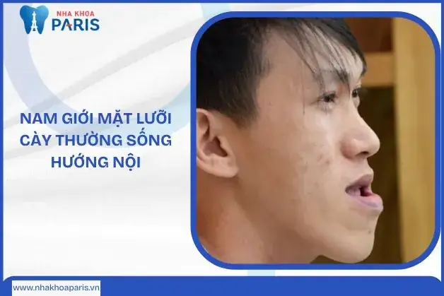 Tướng Mặt Lưỡi Cày Nam Tướng Mặt Lưỡi Cày Nam