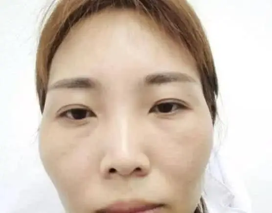 Tướng Mặt Ngựa