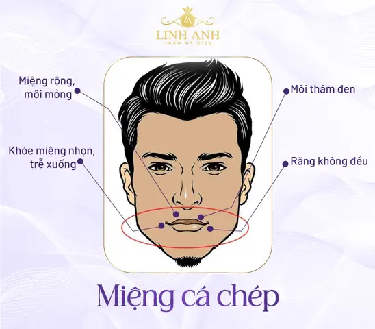 Tướng Môi Cá Chép