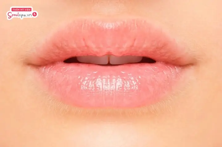 Tướng Môi Hạt Đậu