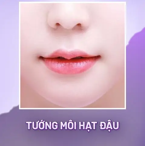 Tướng Môi Hạt Đậu