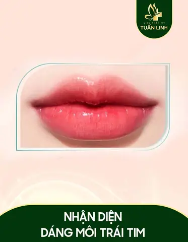 Tướng Môi Trái Tim