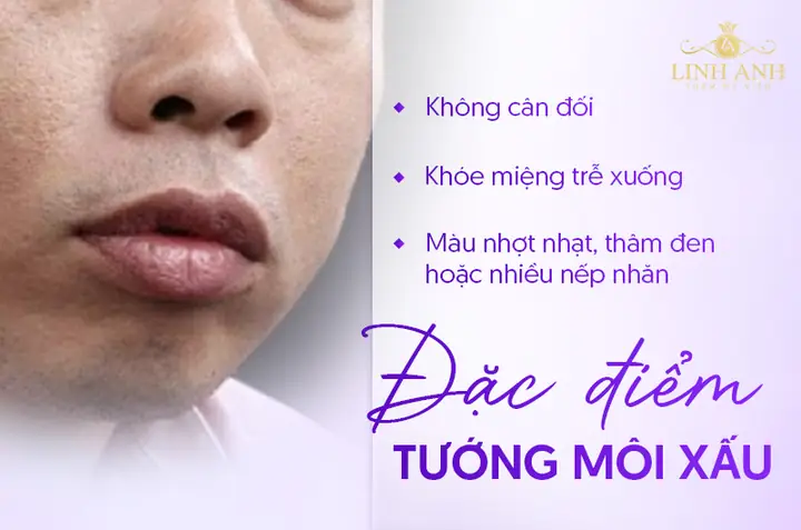Tướng Môi Xấu