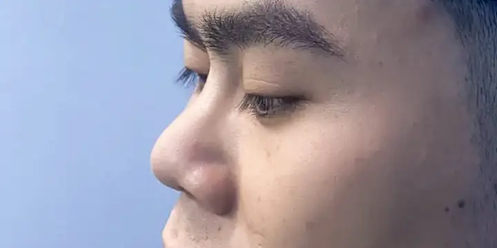 Tướng Mũi Đàn Ông Xấu