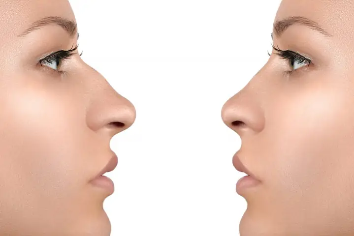 Tướng Mũi Diều Hâu Nữ