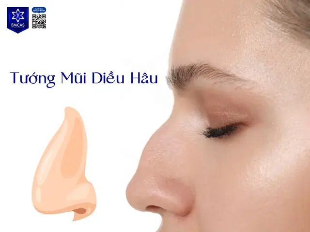 Tướng Mũi Diều Hâu Nữ