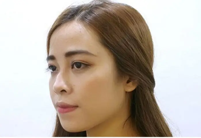 Tướng Mũi Gãy Phụ Nữ