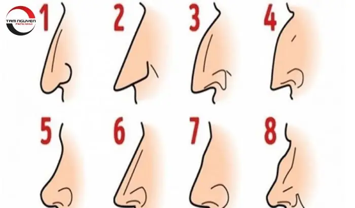 Tướng Mũi Gãy Phụ Nữ