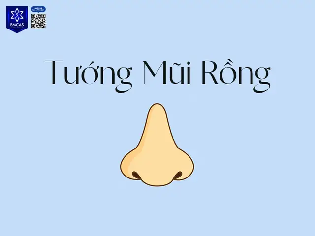 Tướng Mũi Giữ Tiền