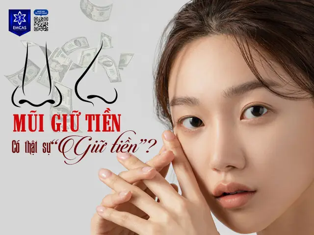 Tướng Mũi Giữ Tiền