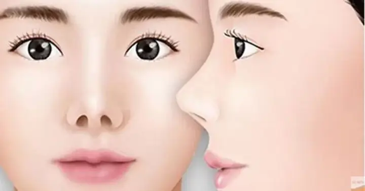 Tướng Mũi Hếch