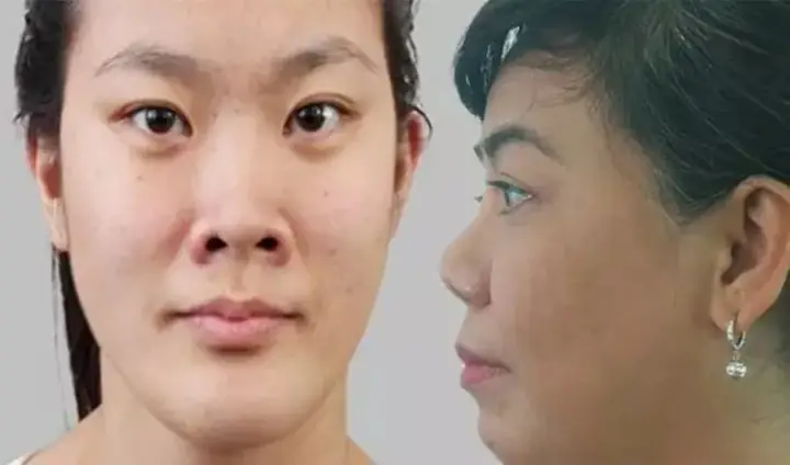Tướng Mũi Hếch Phụ Nữ