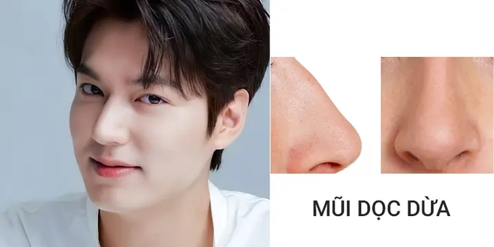 Tướng Mũi Không Nên Sửa
