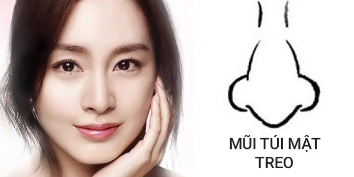 Tướng Mũi Không Nên Sửa