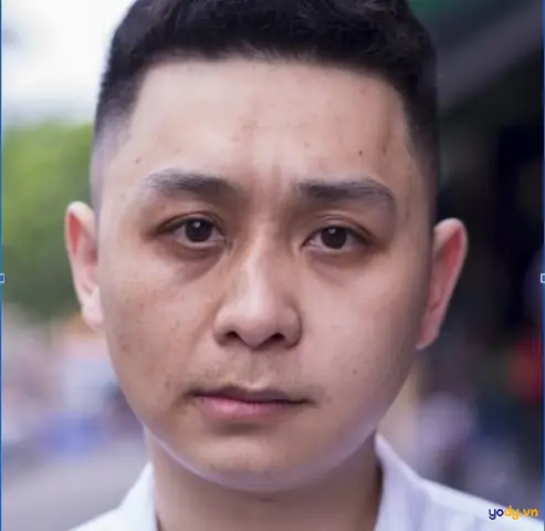 Tướng Mũi Lệch Trái