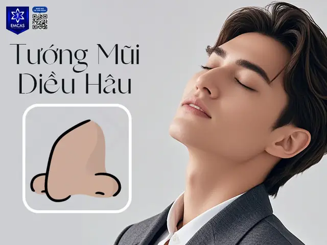 Tướng Mũi Lớn