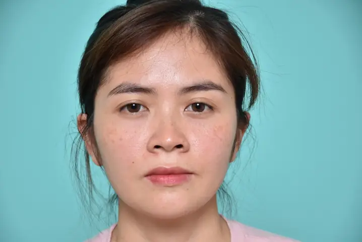 Tướng Mũi Tẹt