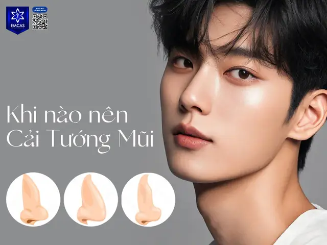 Tướng Mũi To Nam