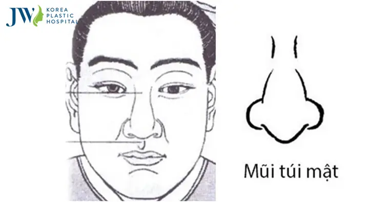 Tướng Mũi Túi Mật