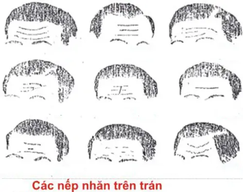 Tướng Nếp Nhăn Trên Trán Đàn Ông Tướng Nếp Nhăn Trên Trán Đàn Ông