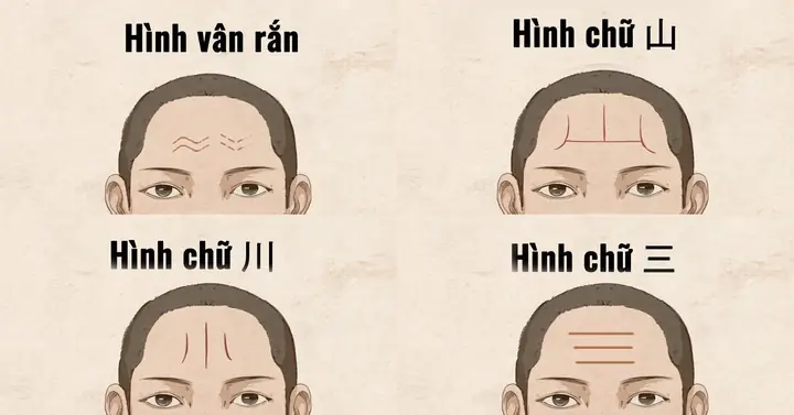 Tướng Nếp Nhăn Trên Trán Phụ Nữ