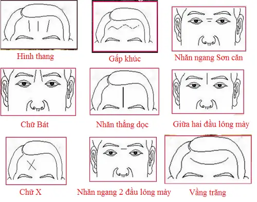 Tướng Nếp Nhăn Trên Trán Phụ Nữ