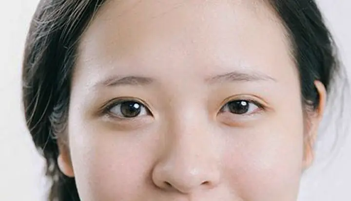 Tướng Người 2 Mí Mắt Không Đều