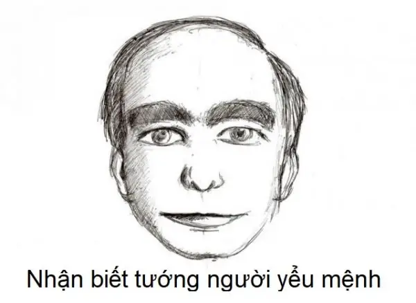 Tướng Người Chết Yểu
