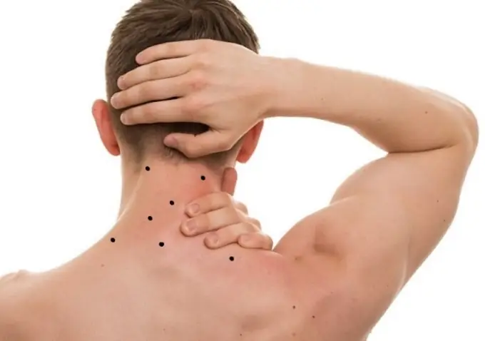 Tướng Người Có Cực U Sau Gáy